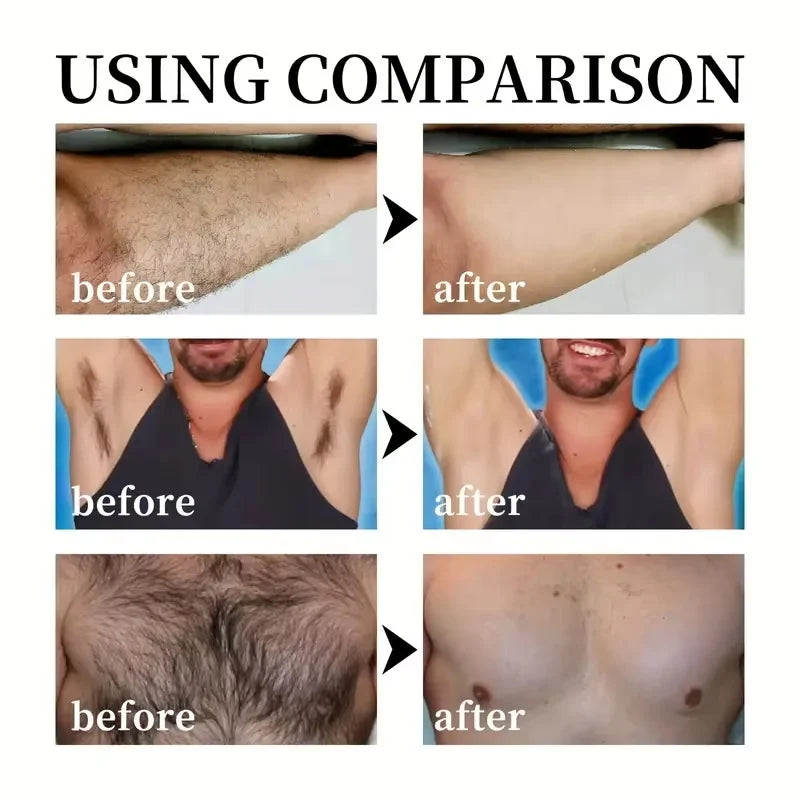 Permanent Hair Removal Cream Hair Growth Inhibitor Face Arm Armpit Leg Intimate Areas Painless Depilatory For Men Women Care